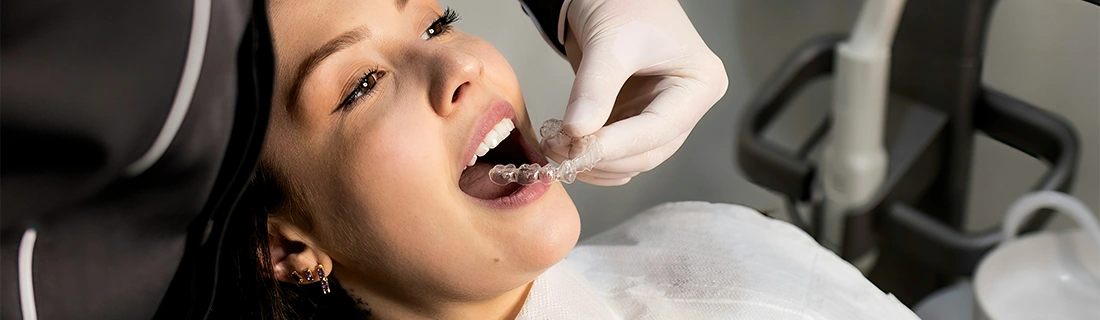 About Invisalign in Miamisburg OH – FC About Invisalign in Miamisburg OH – FC